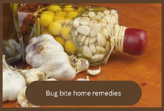 bug bite home remedies